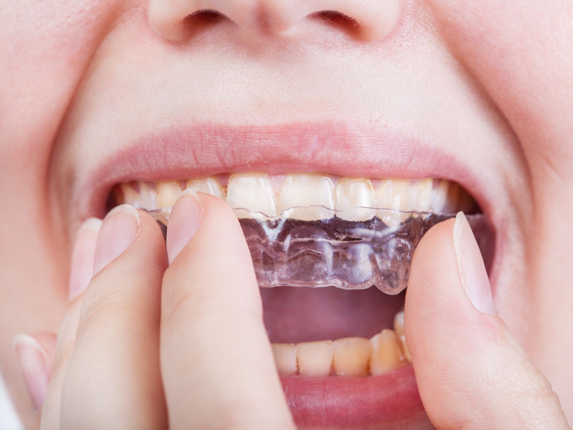 A woman is getting her teeth examined by a dentist.