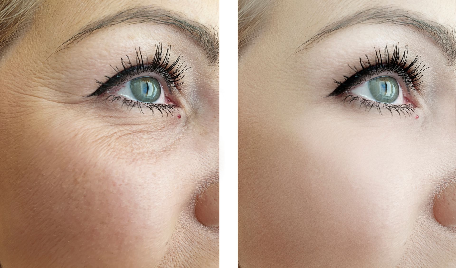 A before and after picture of a woman 's lips with arrows pointing in different directions. A before and after picture of a woman 's lips with arrows pointing in different directions.