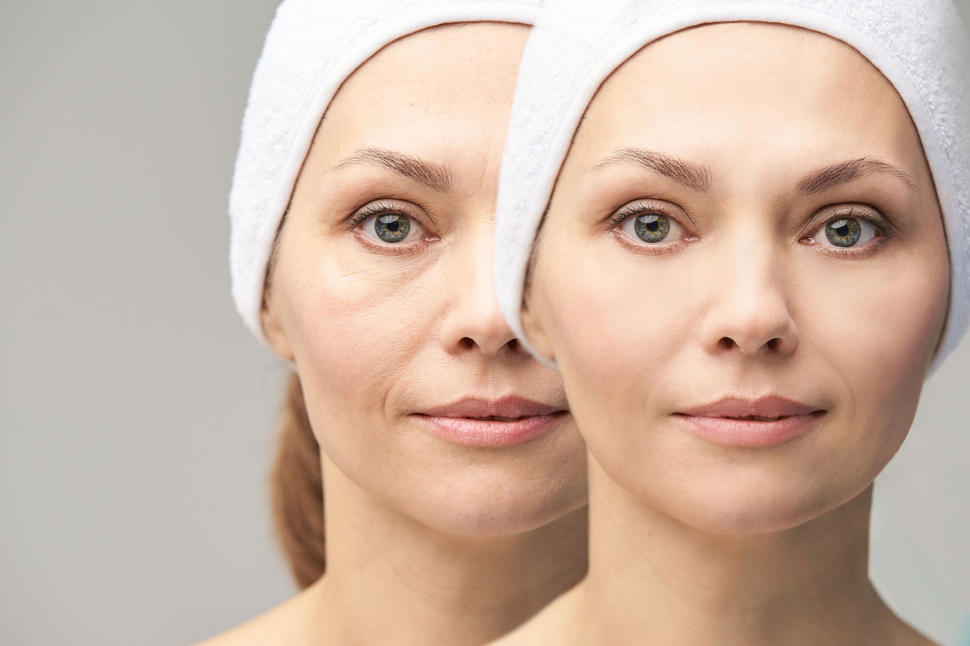 A woman 's face is shown before and after a facial treatment. A woman 's face is shown before and after a facial treatment.