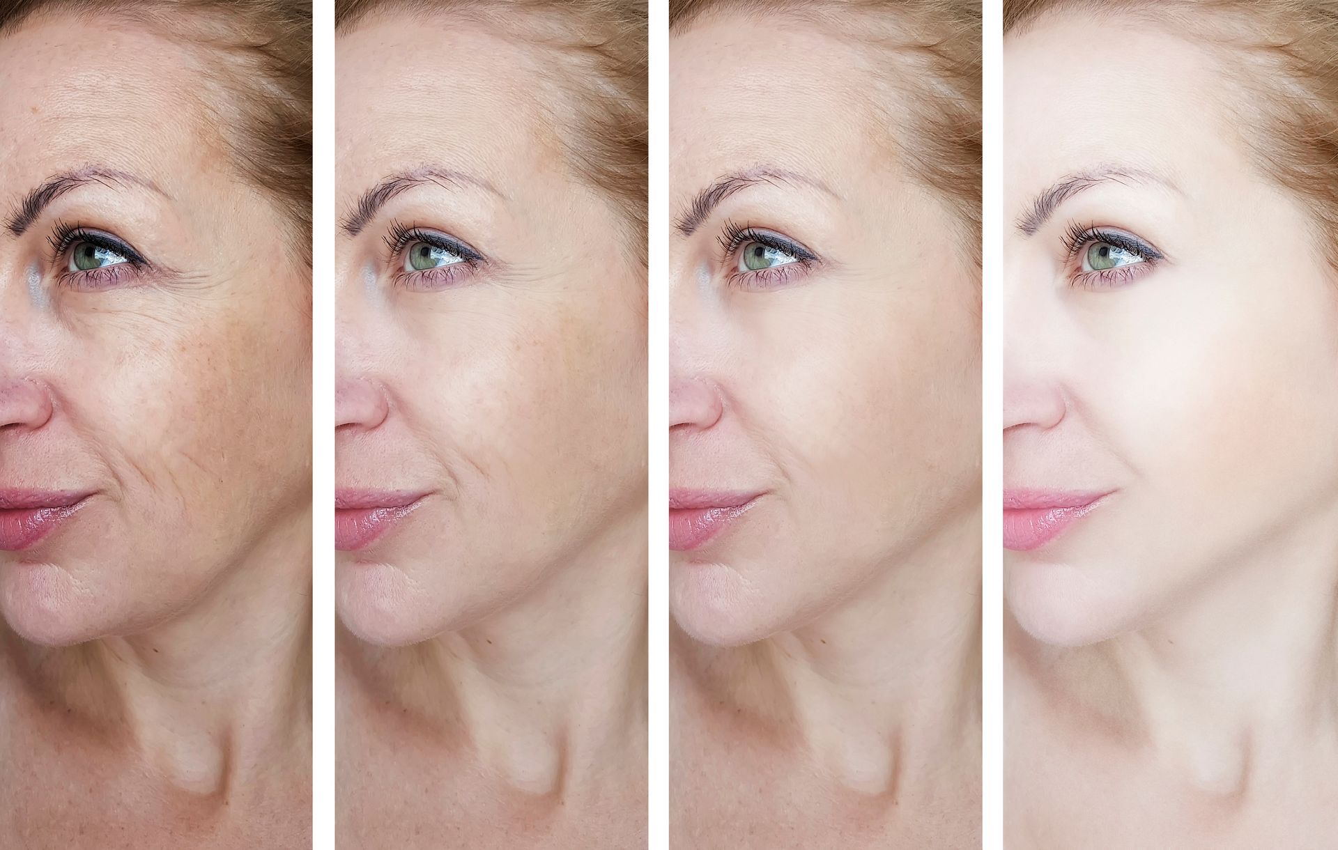 A woman 's face is shown before and after a facial treatment. A woman 's face is shown before and after a facial treatment.