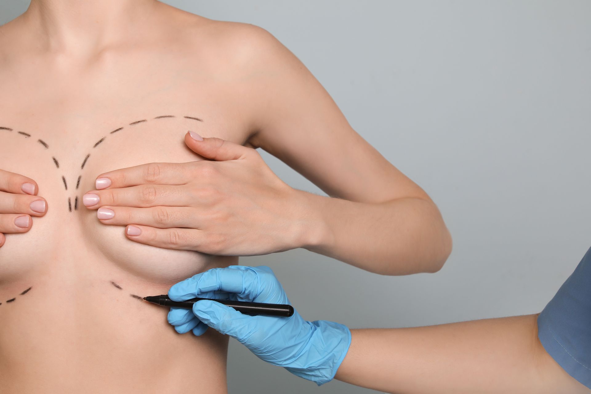 Medical professional marking breasts with a pen during a chest examination
