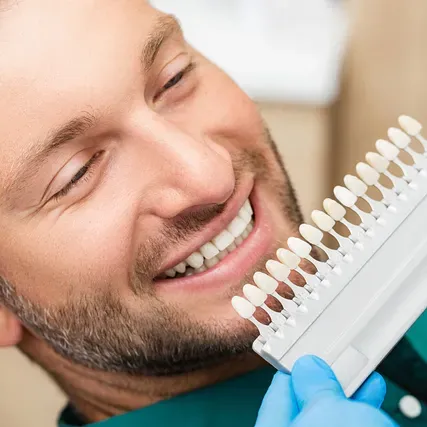man with teeth colored veneers