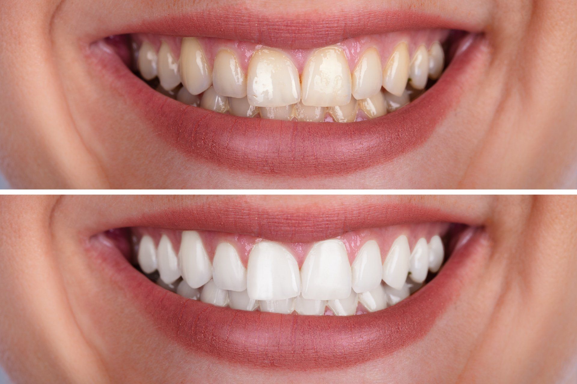 dentista Naldini Livorno estetica del sorriso