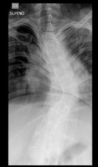 L'ozonoterapia è un potente virucida