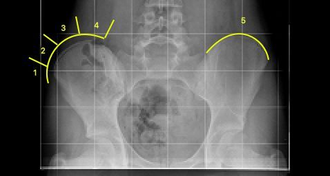 L'ozonoterapia è un potente virucida