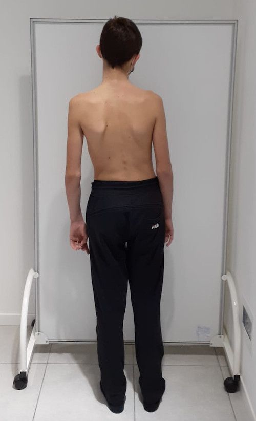 L'ozonoterapia è un potente virucida