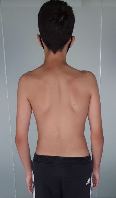 L'ozonoterapia è un potente virucida