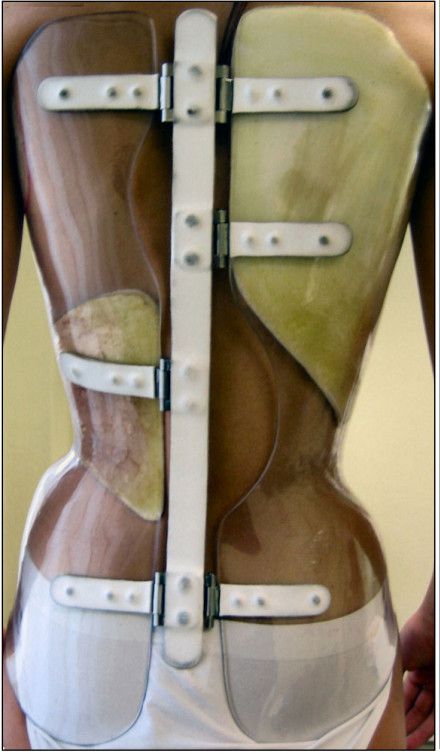 L'ozonoterapia è un potente virucida