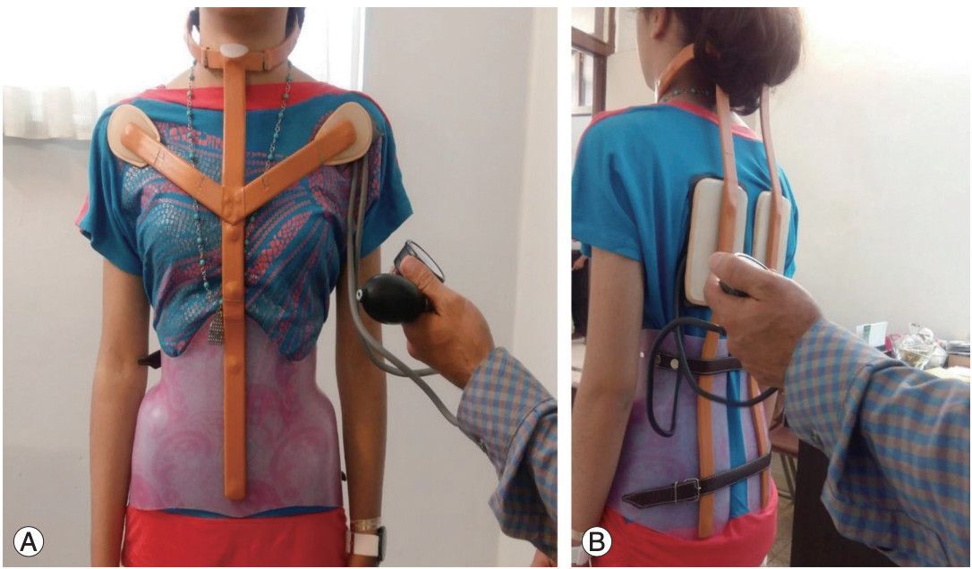 L'ozonoterapia è un potente virucida