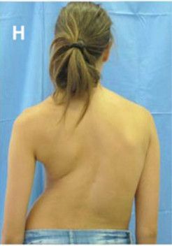 L'ozonoterapia è un potente virucida