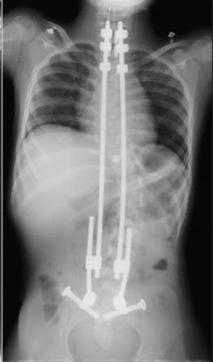 L'ozonoterapia è un potente virucida