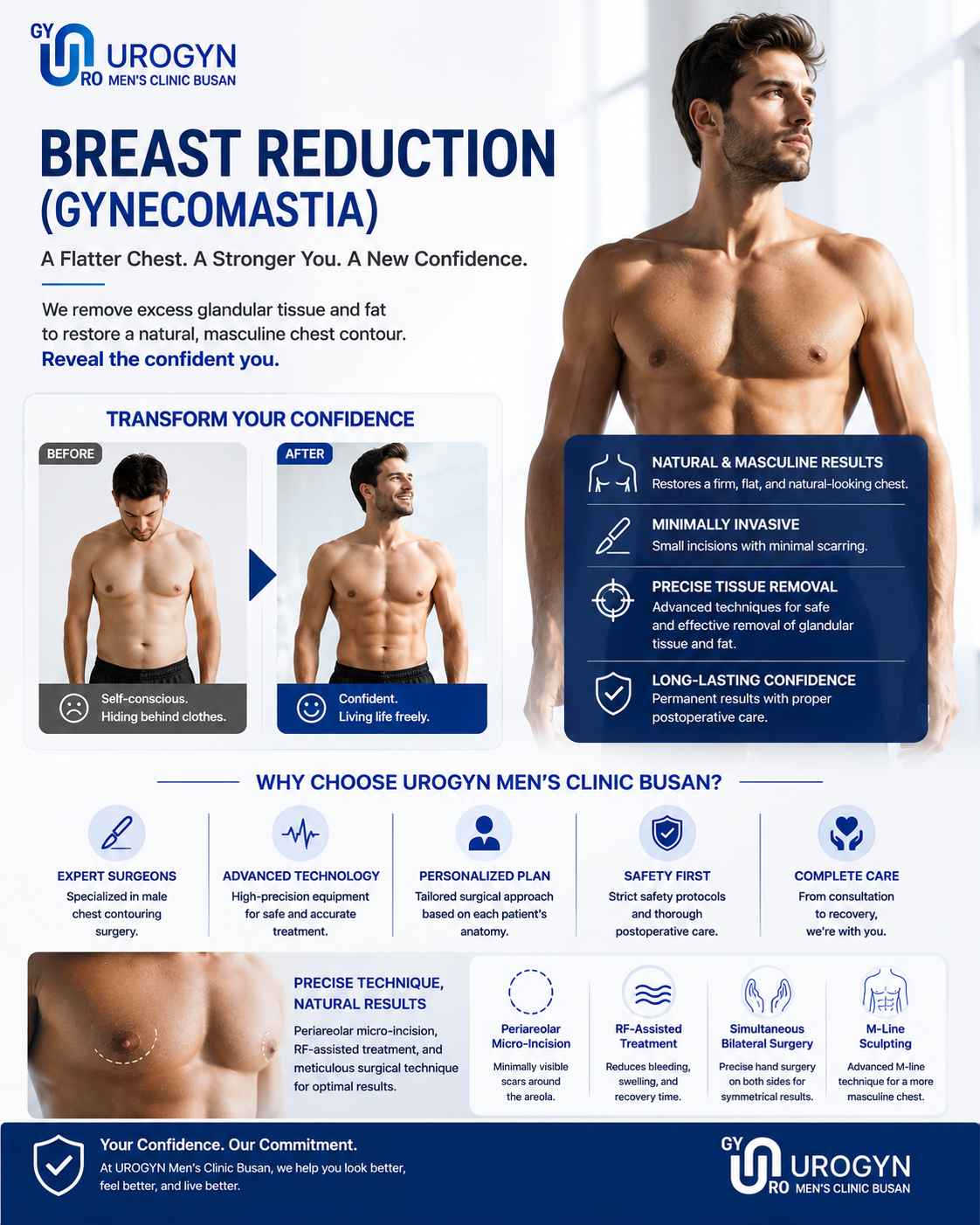 Gynecomastia male breast reduction at Urogyn Men's Clinic Busan