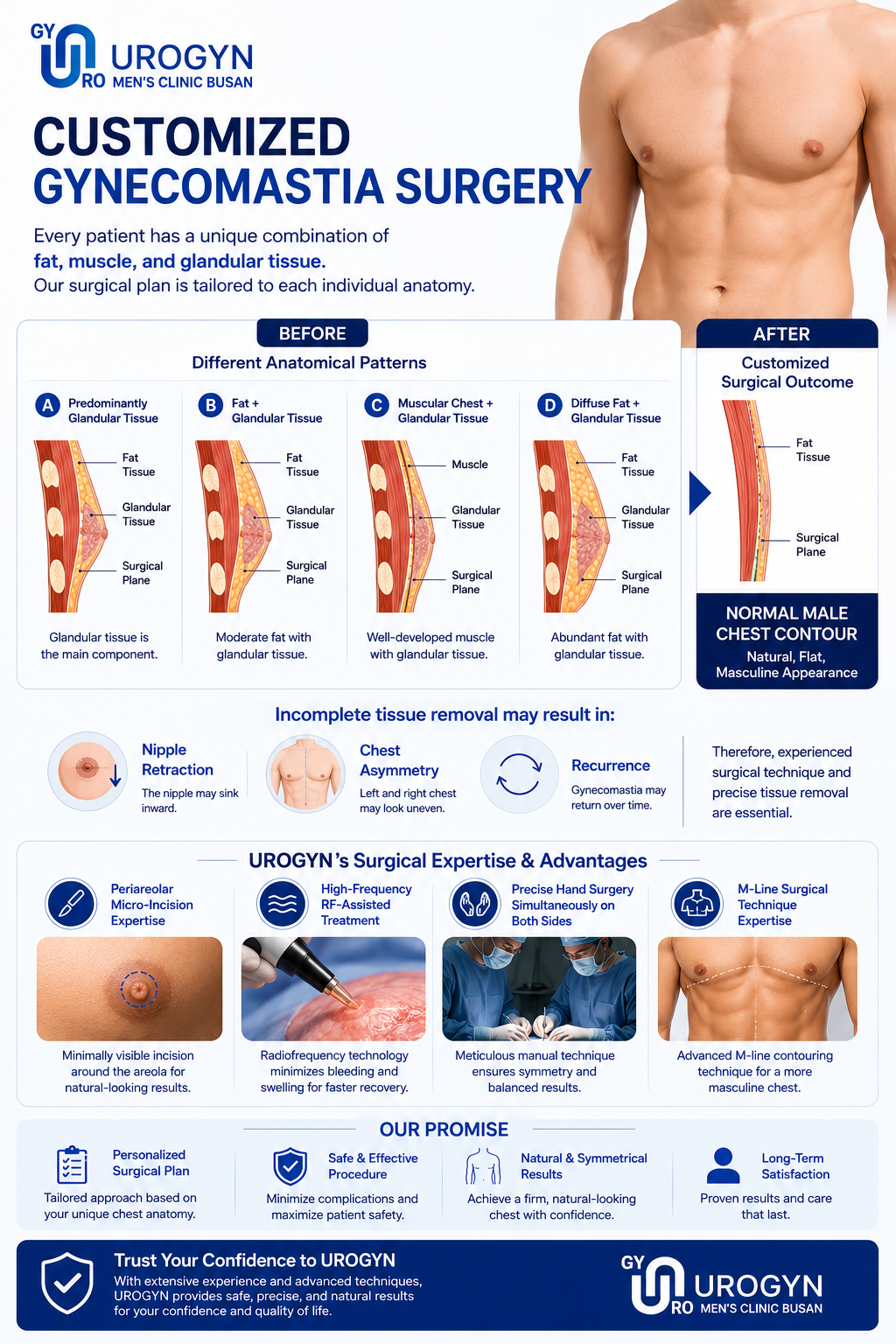 VASER gynecomastia surgical procedure at Urogyn Men's Clinic Busan Seomyeon