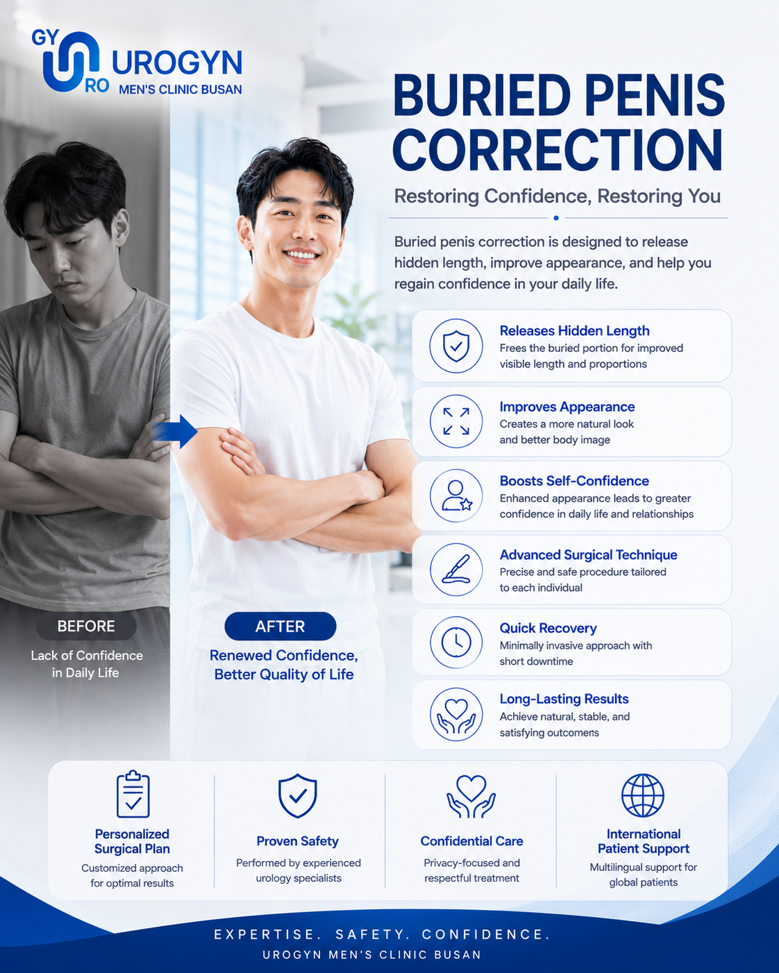 Buried penis correction at Urogyn Men's Clinic Busan Seomyeon