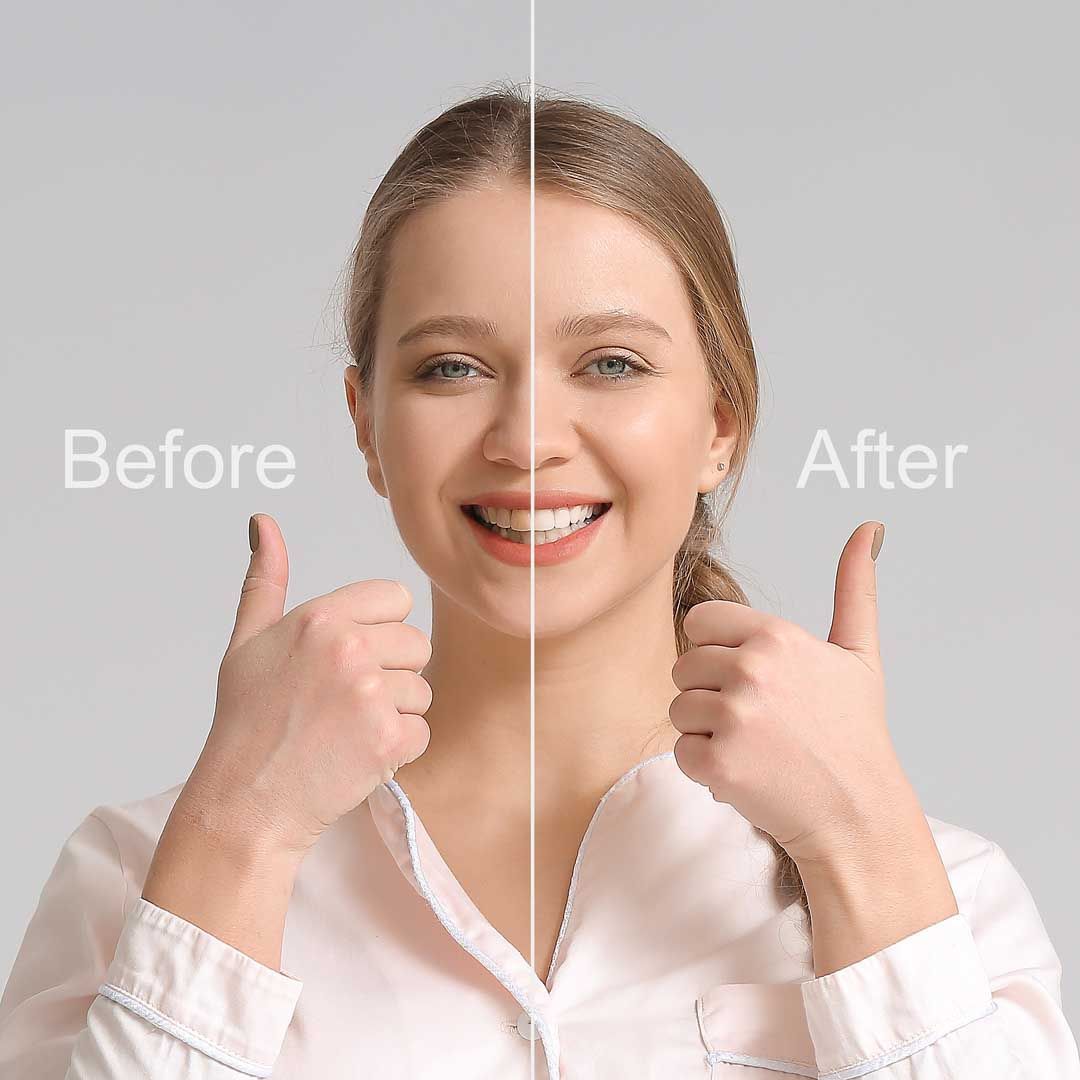 Smile Makeovers