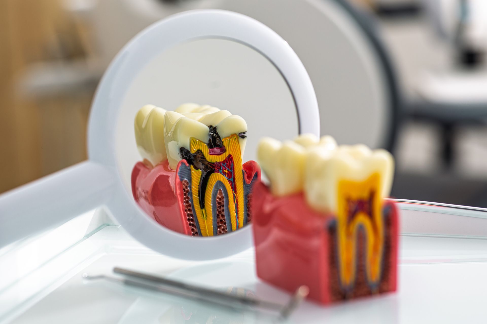 Tooth model with cavity reflected in a dental mirror, with dental tools in view.