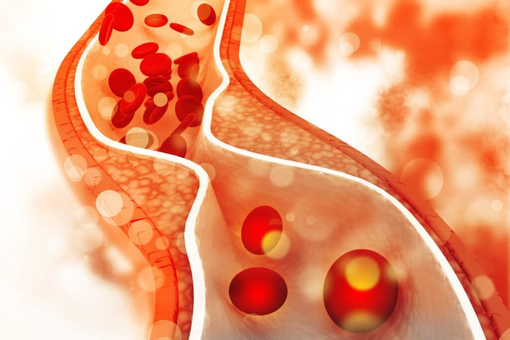 Omega 3: een krachtige bondgenoot tegen depressie 