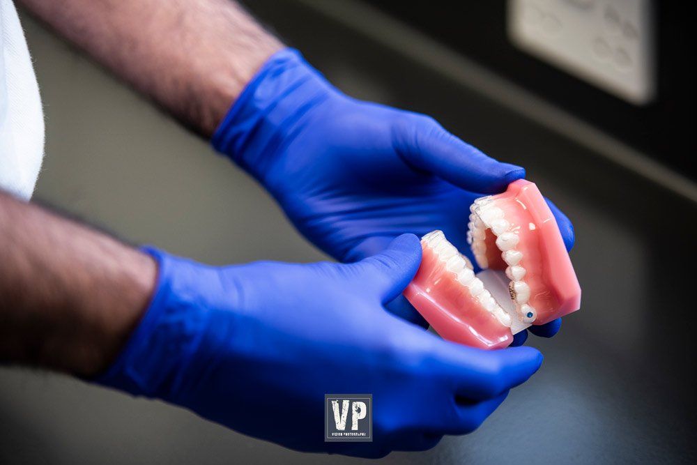 dental photography at earby dental