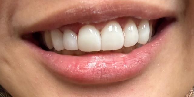 Close-up of a smiling mouth with white teeth and pink lips