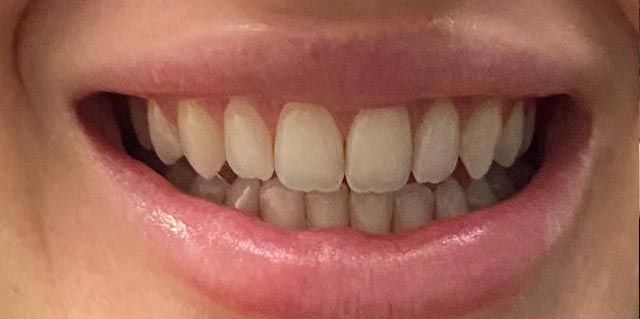 Close-up of a smiling mouth showing white teeth and pink lips