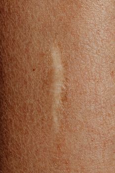 The Heal Dermatology Seoul