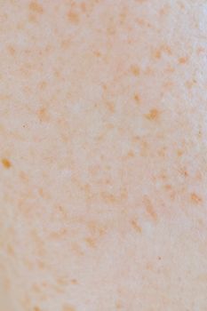 Seoul patient guide, The Heal Dermatology