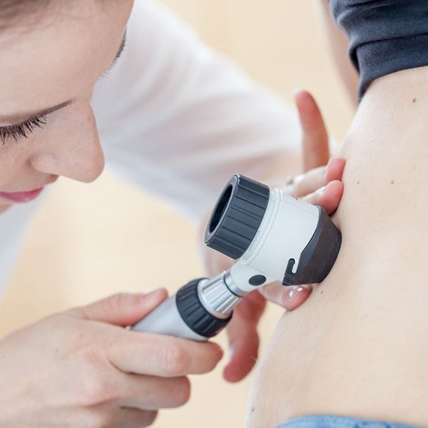 Dermatologist examining skin with a handheld dermatoscope on an arm