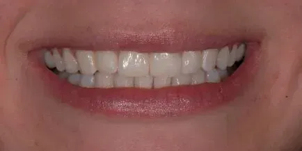 Smiling mouth, showing white teeth, and pink lips.