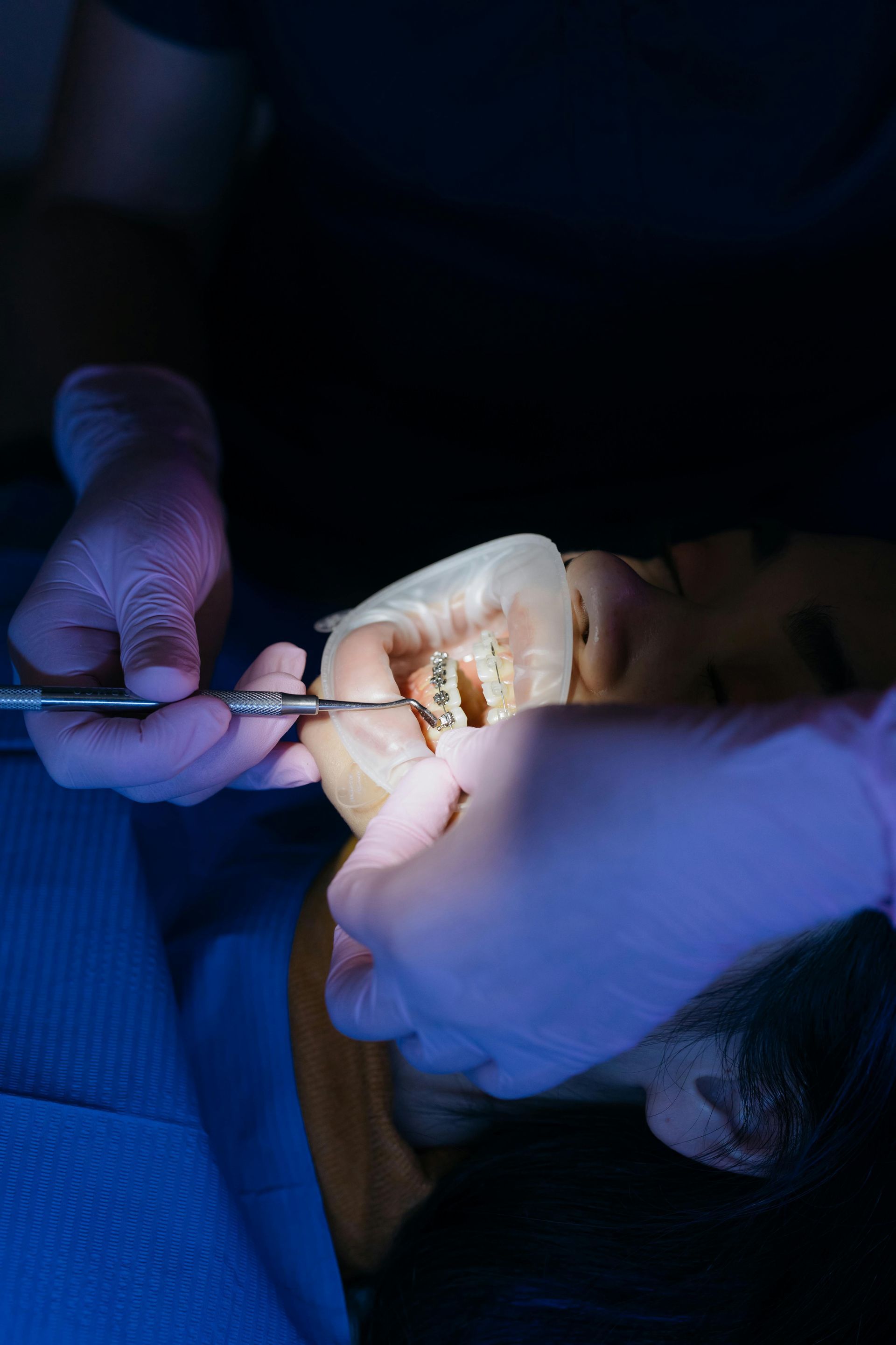 Dentures