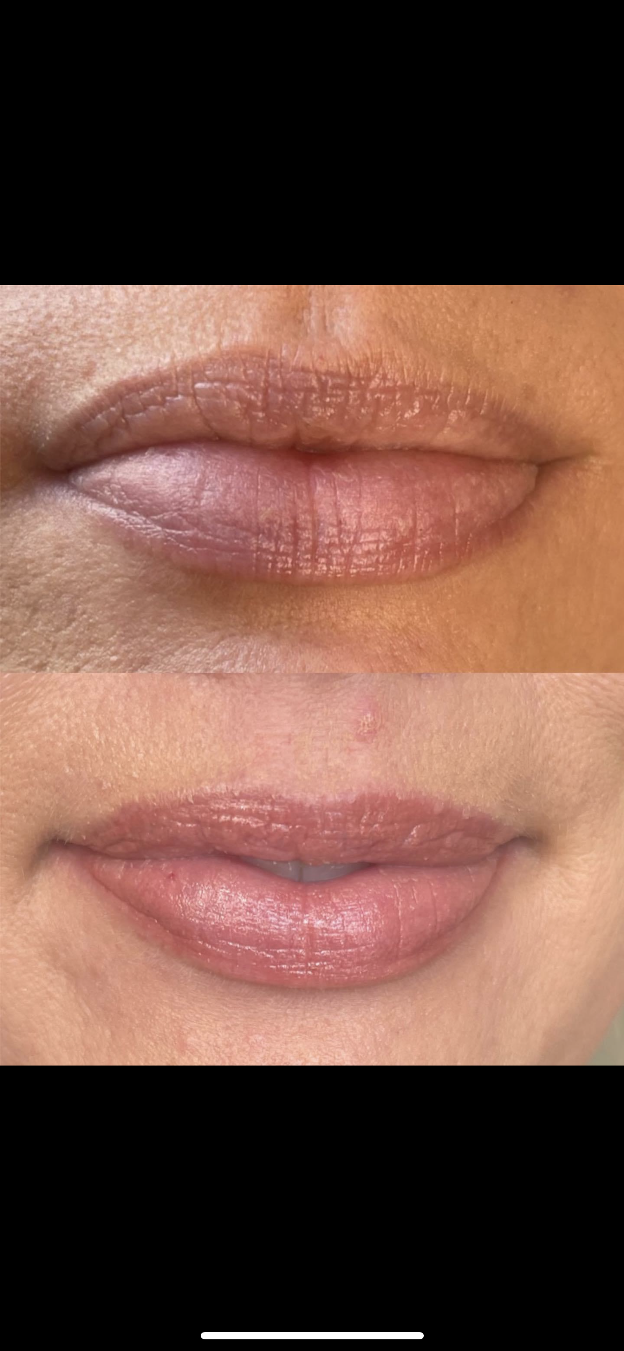 A before and after picture of a woman 's lips.