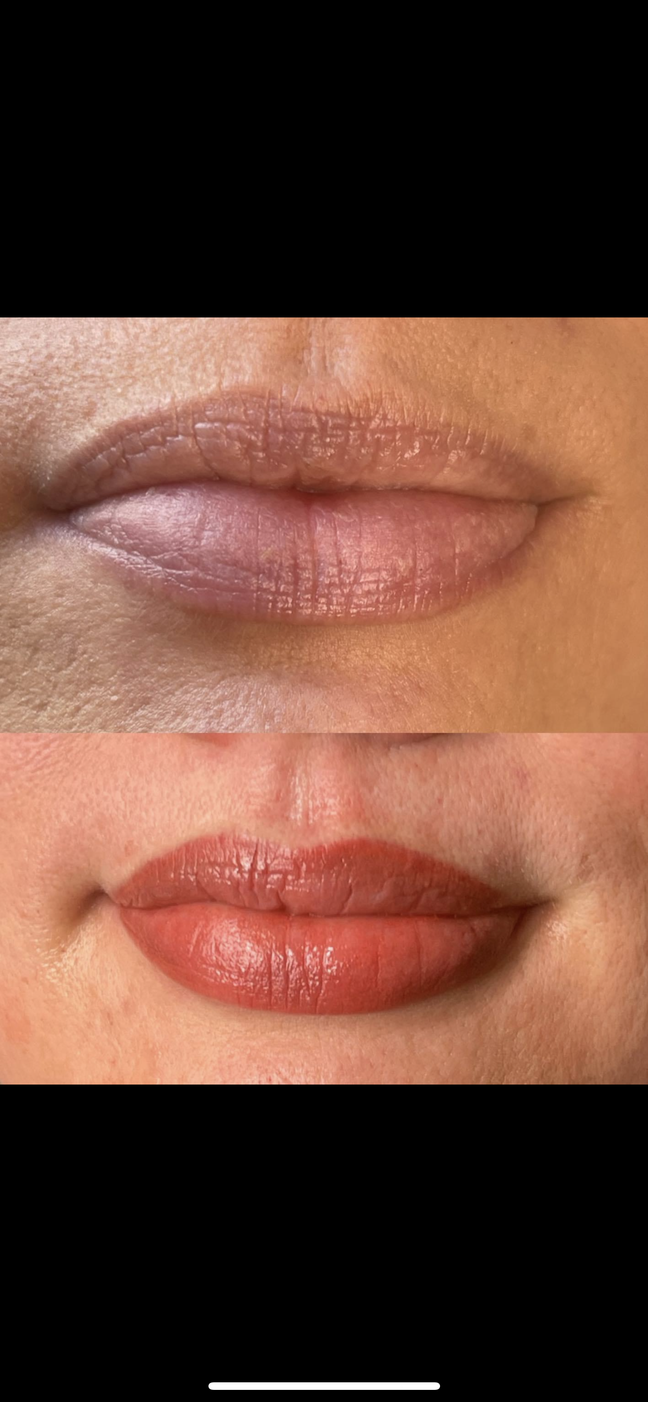A before and after picture of a woman 's lips.