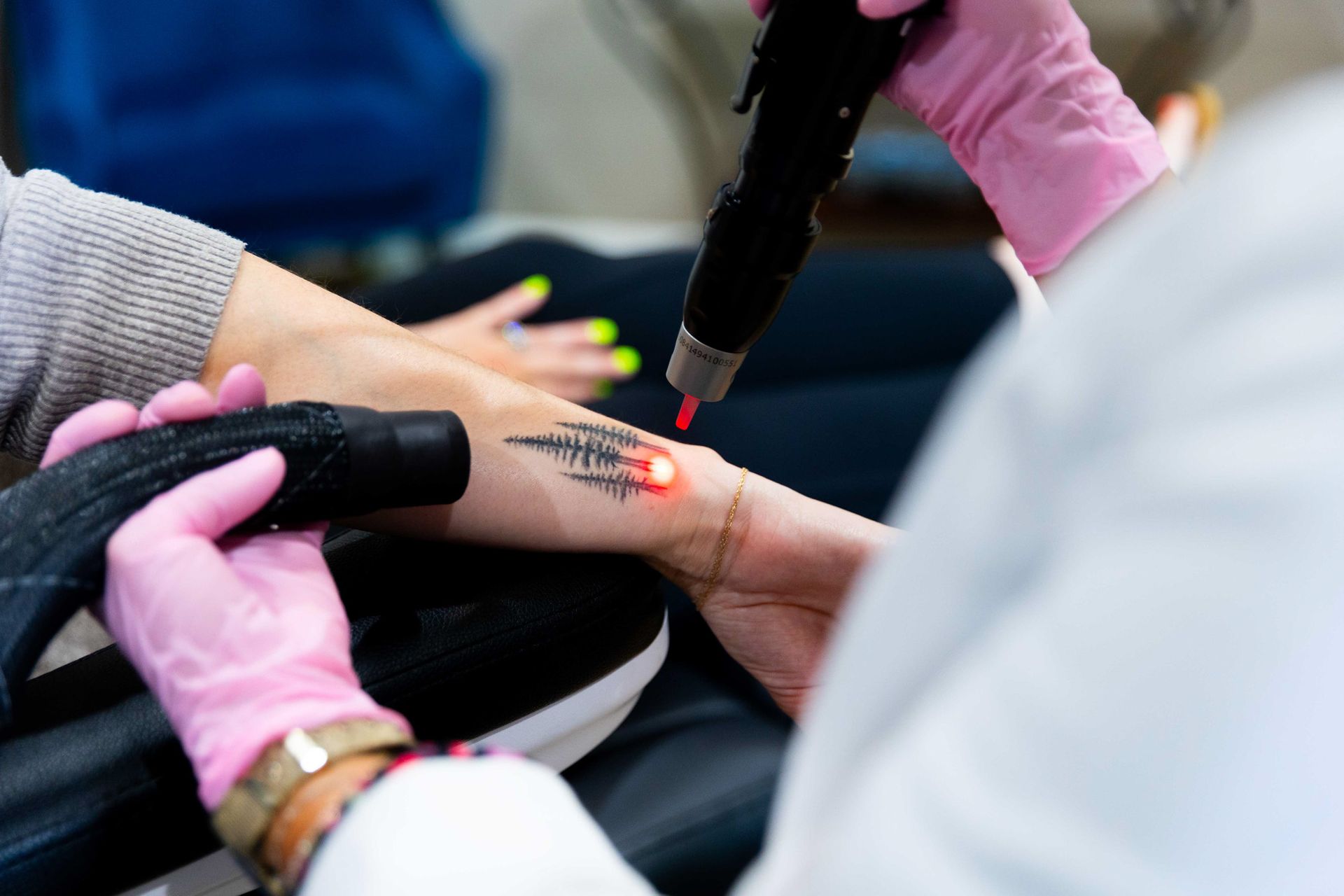 A woman is getting a tattoo removed from her arm.