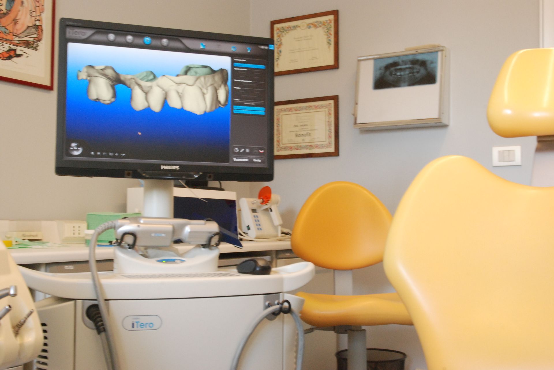 Studio dentistico, monitor che mostra una scansione dentale 3D. Poltrona odontoiatrica gialla.