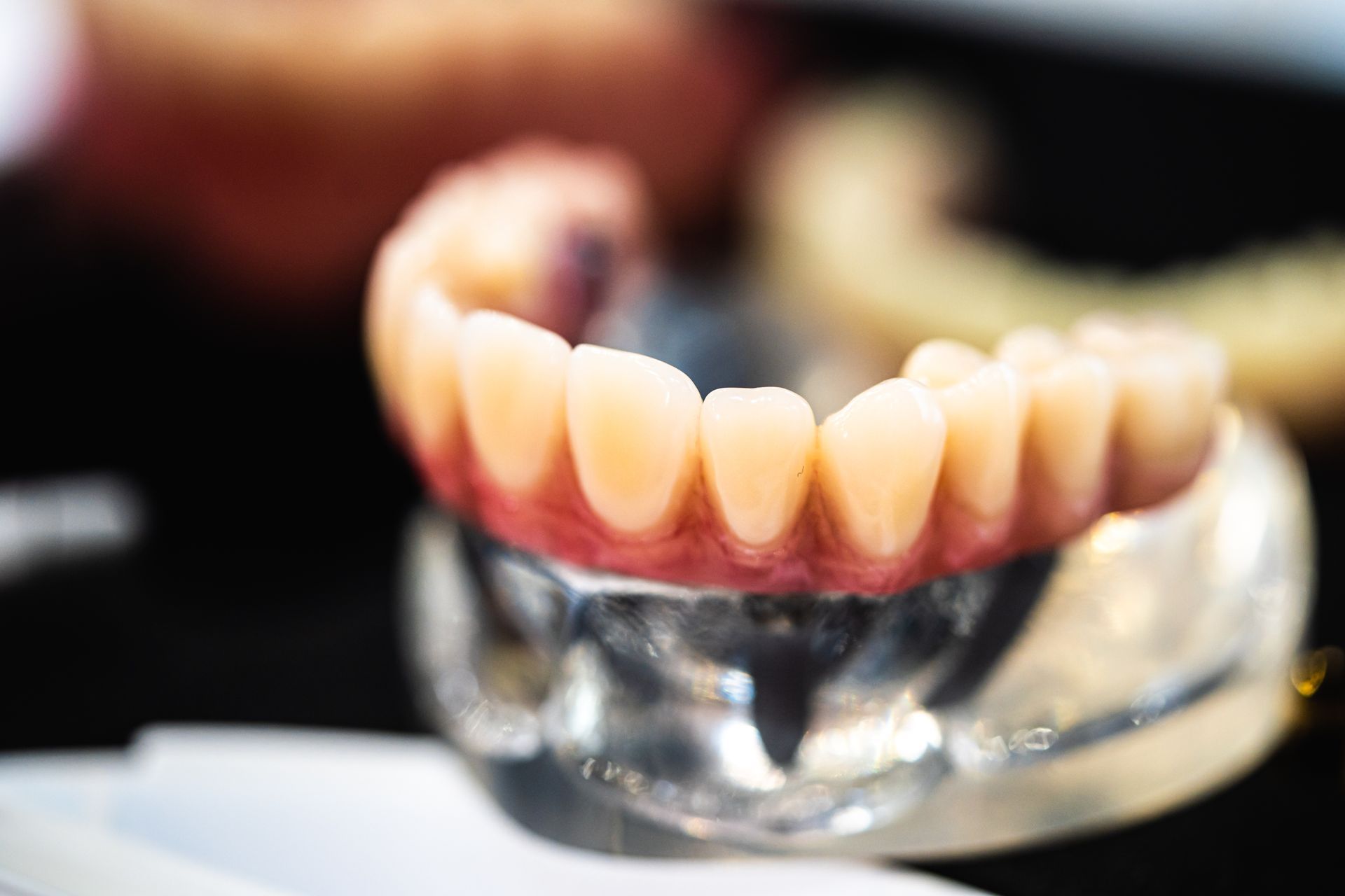 Serie di protesi dentarie superiori su un modello di plastica trasparente, con gengive rosa e denti bianchi, in una vista ravvicinata.