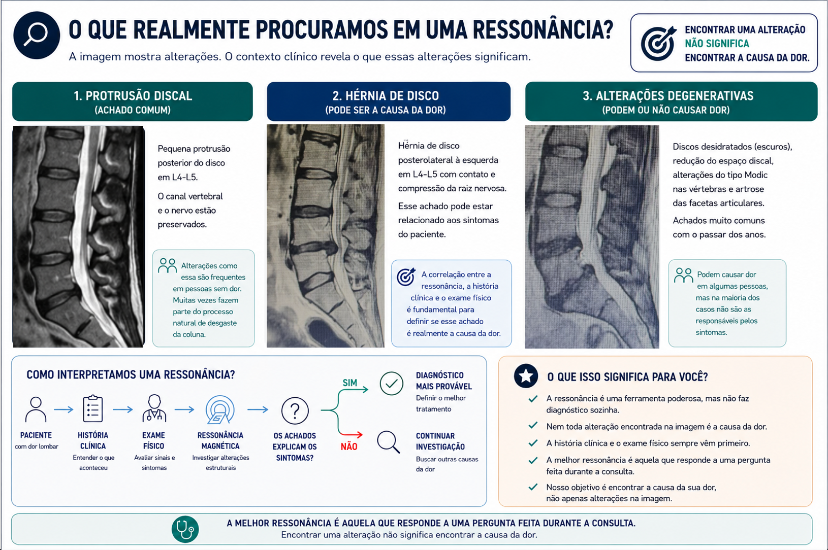 Infográfico explicando como interpretar uma ressonância magnética da coluna lombar, destacando a diferença entre alterações comuns do envelhecimento e achados que realmente explicam os sintomas do paciente.