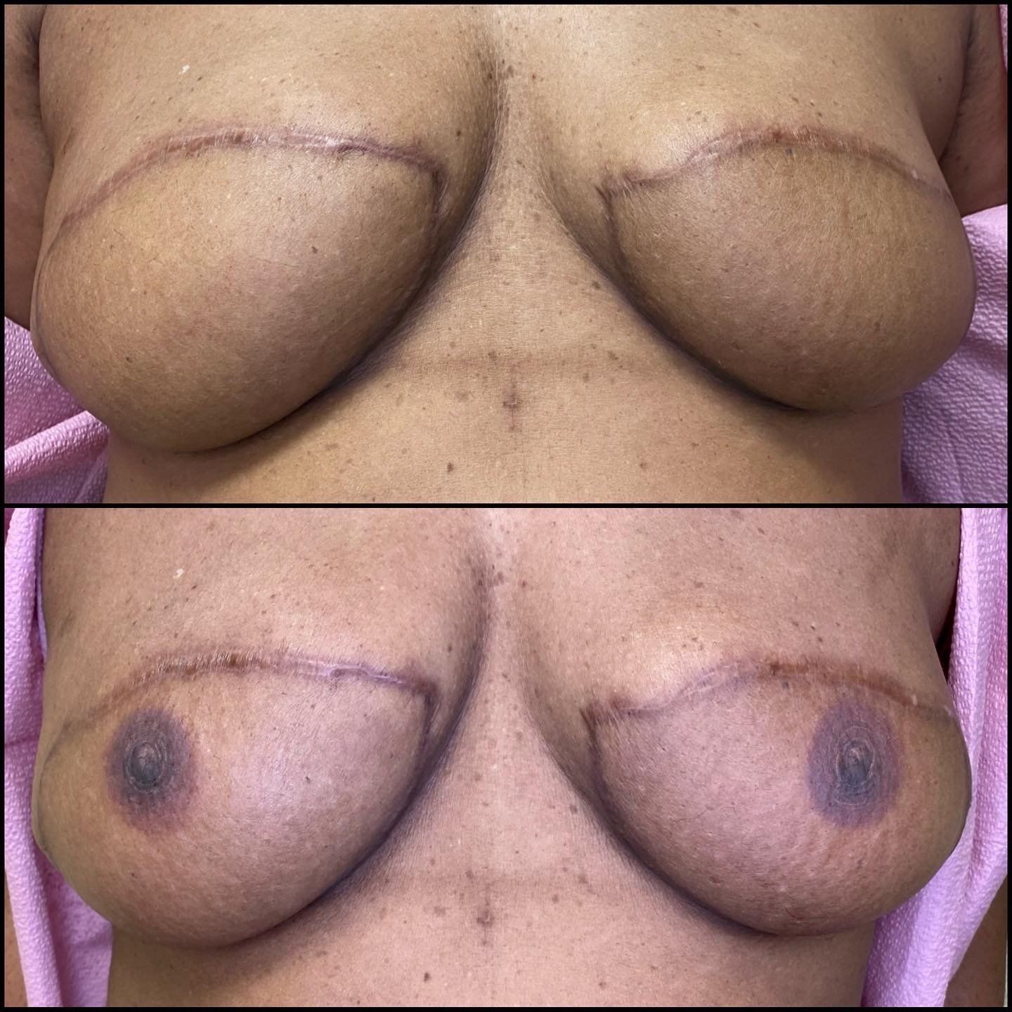 Before and After