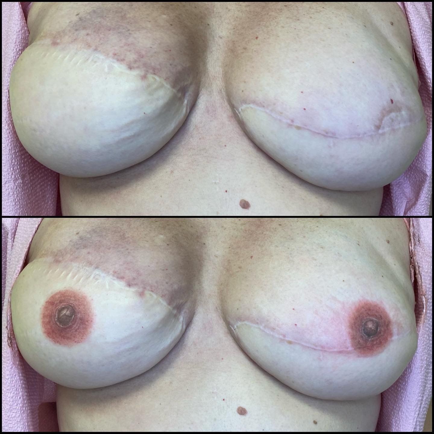 Before and after