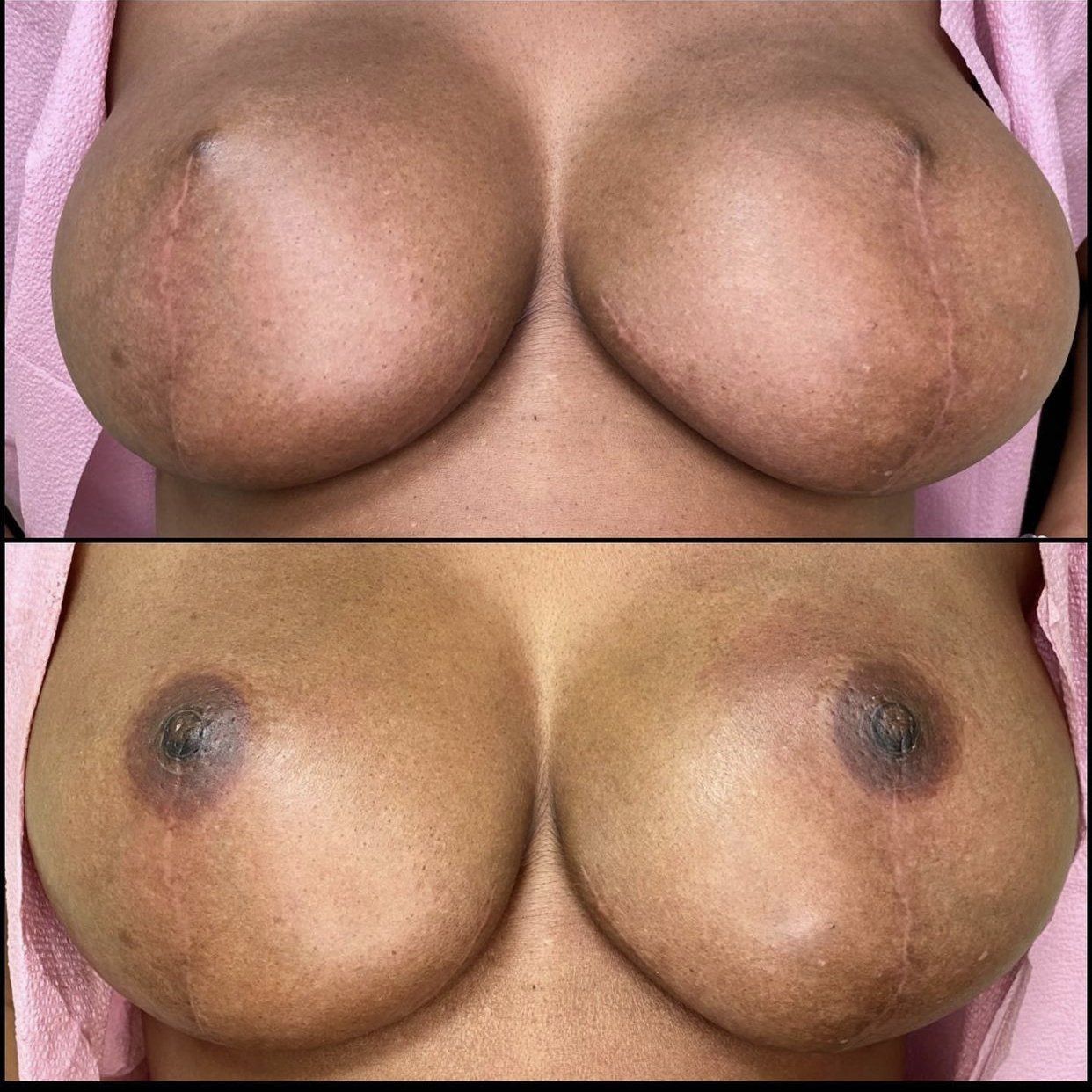 Before and after