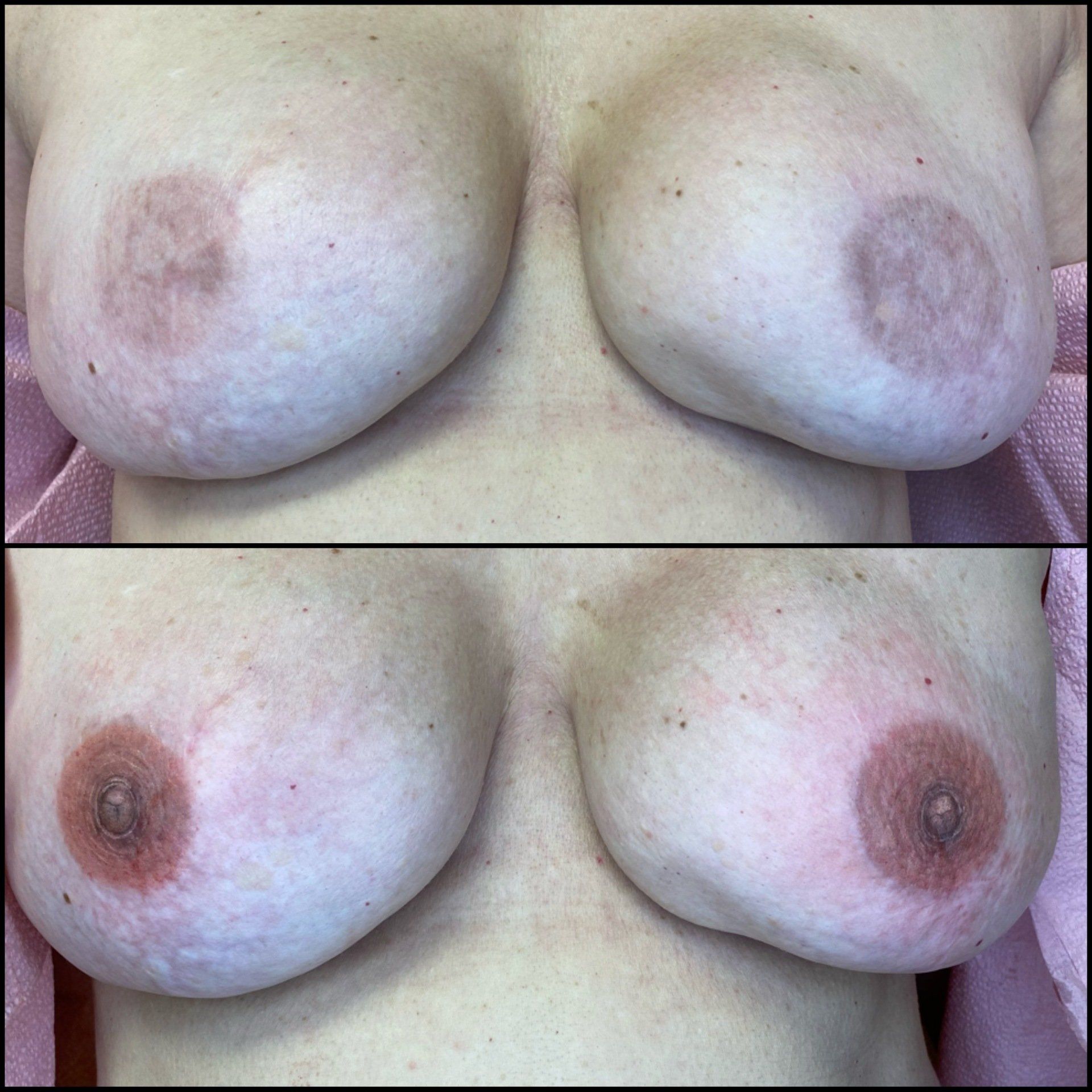 Before and After
