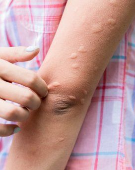 Holistic Allergy Treatments NYC by Dr. Dana Cohen MD. Natural Remedies for Severe and Chronic Allergies by Leading Practitioner in Manhattan NY 10019