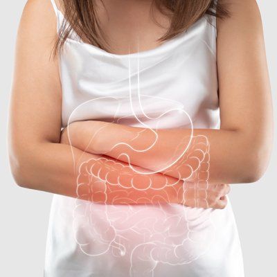 Woman with Crohns Disease