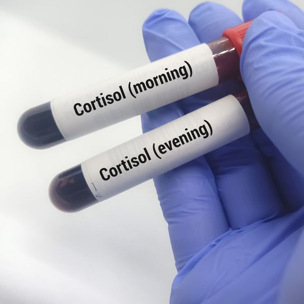 Gloved hand holding two labeled cortisol test tubes, morning and evening, with dark liquid inside