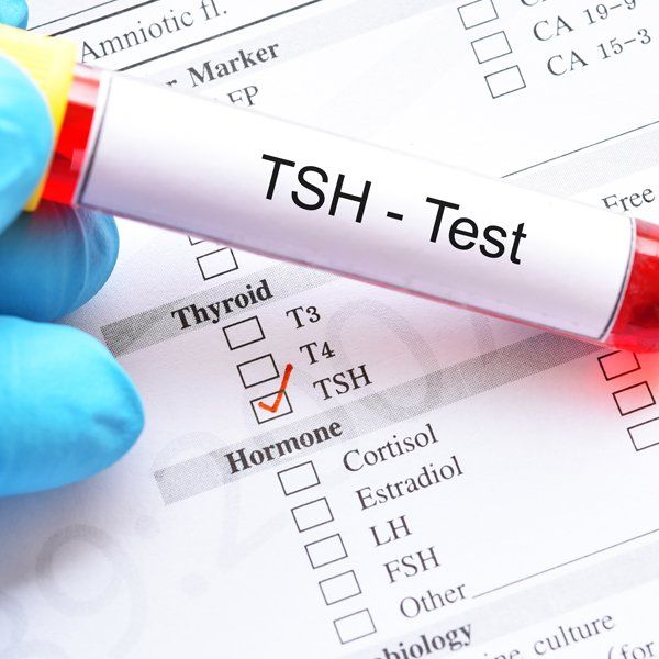 Hypothyroid Disorder Treatment in NYC