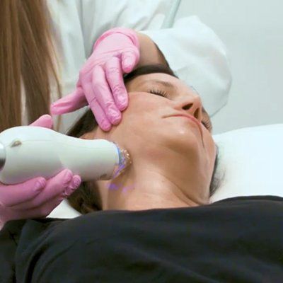 Skin Tightening Proceedure