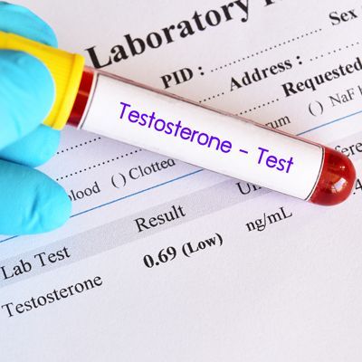 A test tube with testosterone written on it represents Testosterone Replacement Therapy NYC by Dr. Dana Cohen, MD, Natural Remedies for Low Testosterone in Manhattan, NY 10019