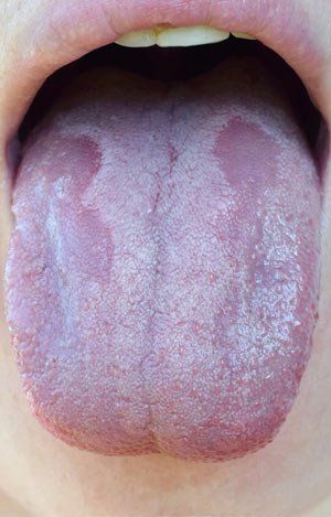 Proven Candida Treatments NYC by Dr. Dana Cohen MD. Natural Remedies for the Treatment of Candida and Yeast Infections in Manhattan NY 10019.