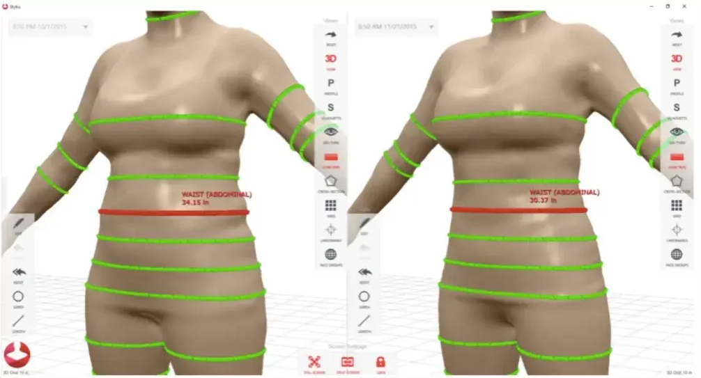 3D body scan in Provo, UT