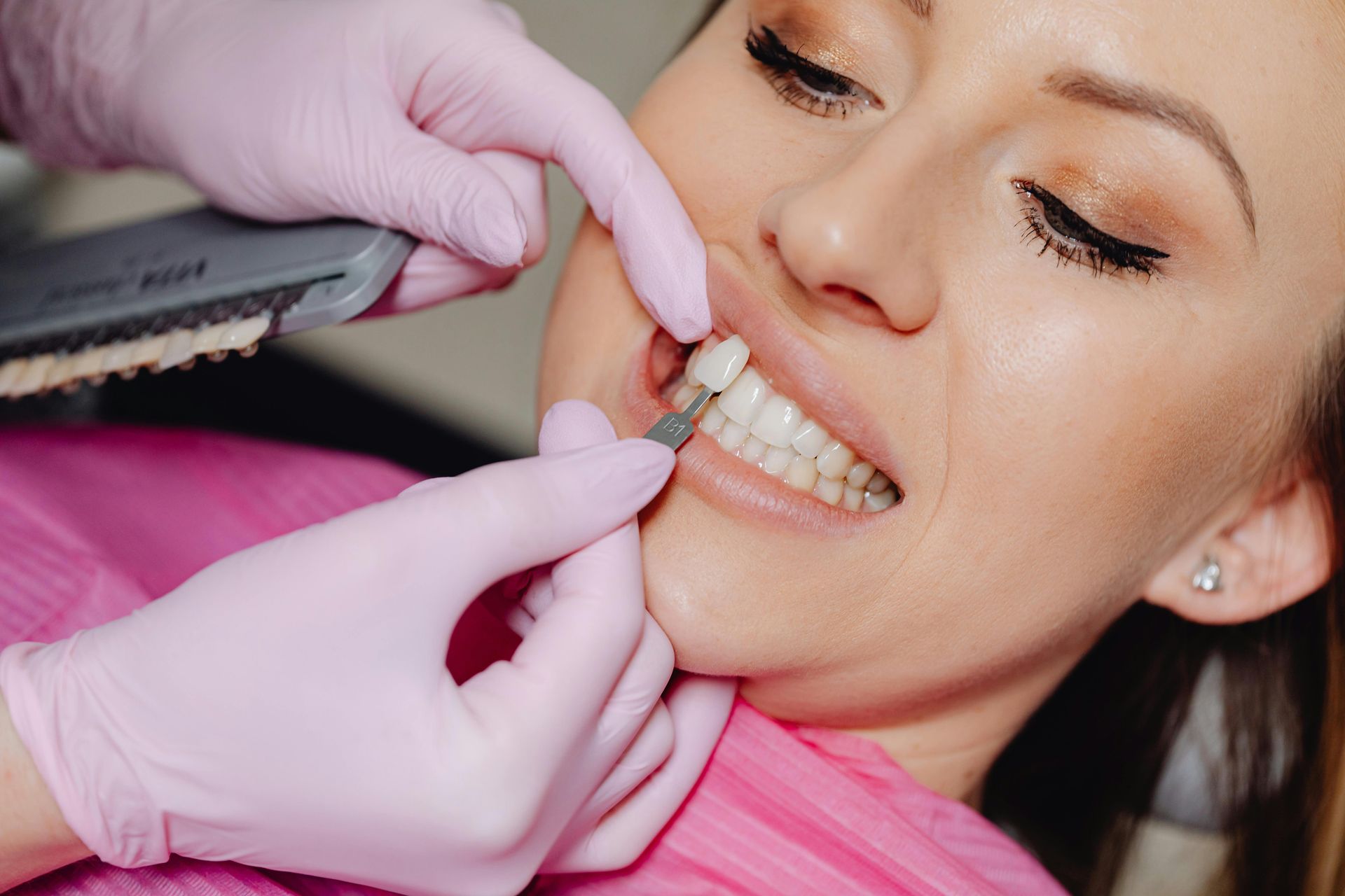 Woman demonstrating areas for cosmetic injections: frown lines, crow's feet, jawline.