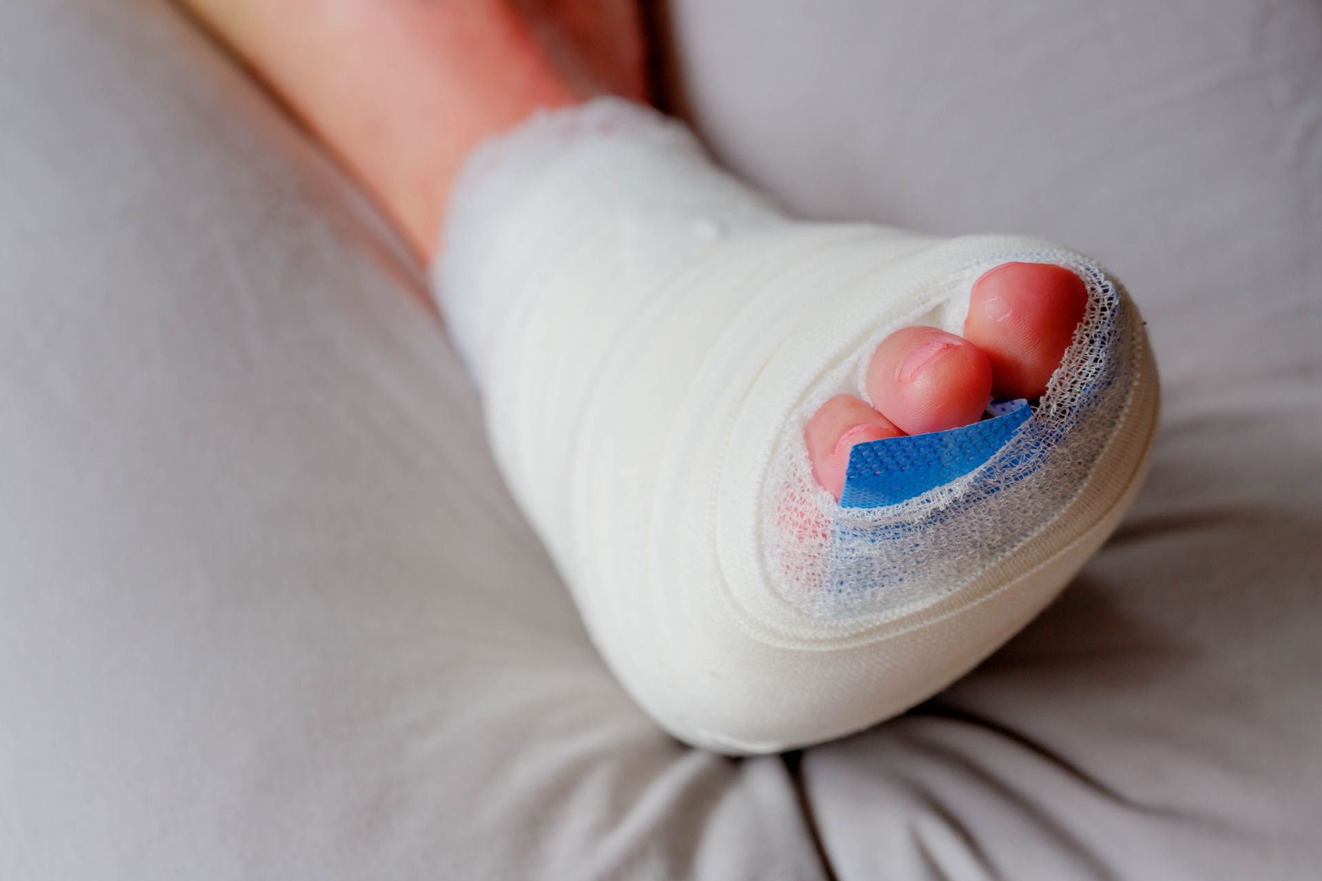 Foot in a white cast resting on a gray cushion, with toes exposed and blue padding visible