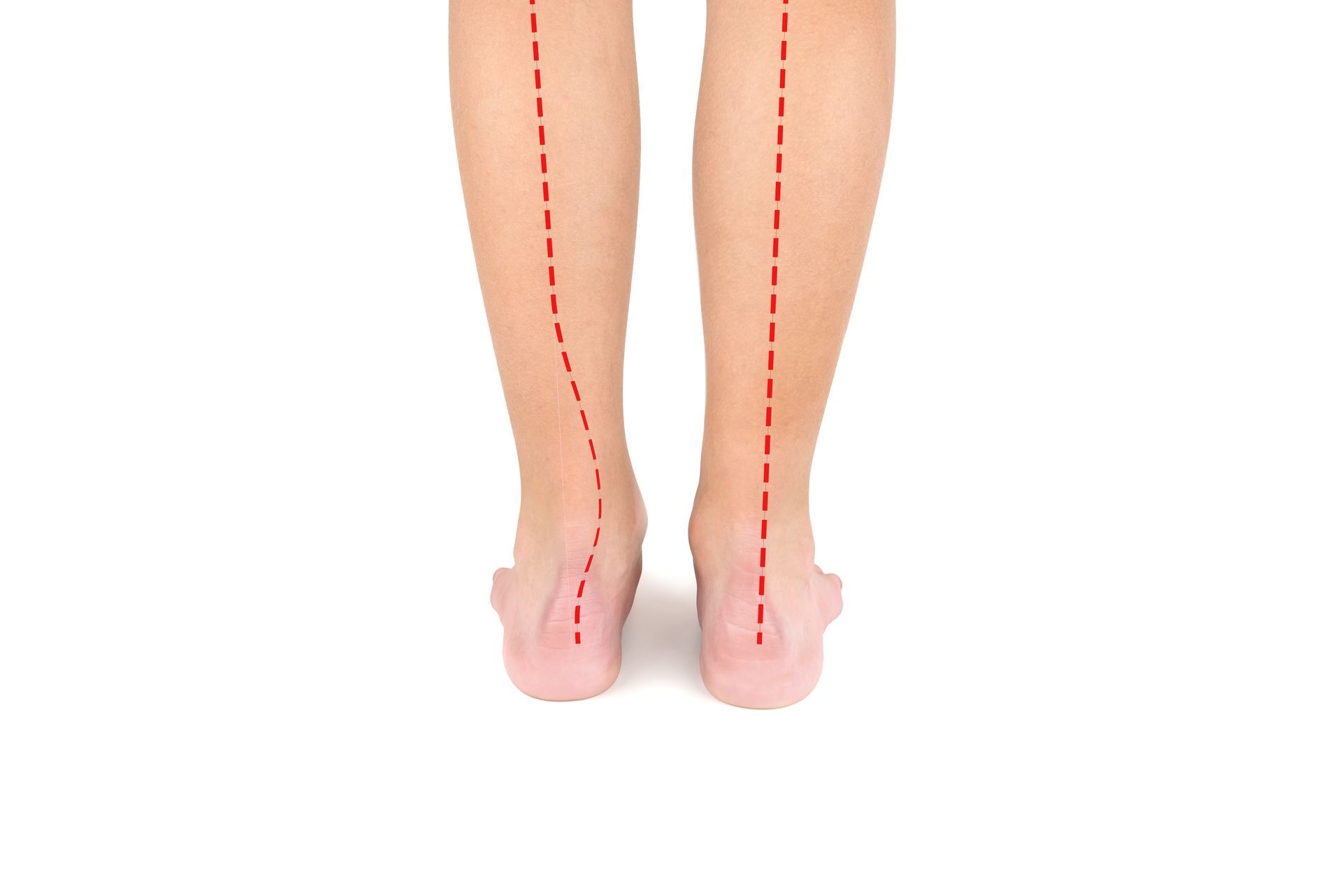 Foot & Ankle Surgery